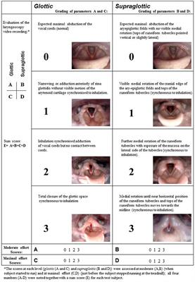 Severe Exercise-Induced Laryngeal Obstruction Treated With Supraglottoplasty